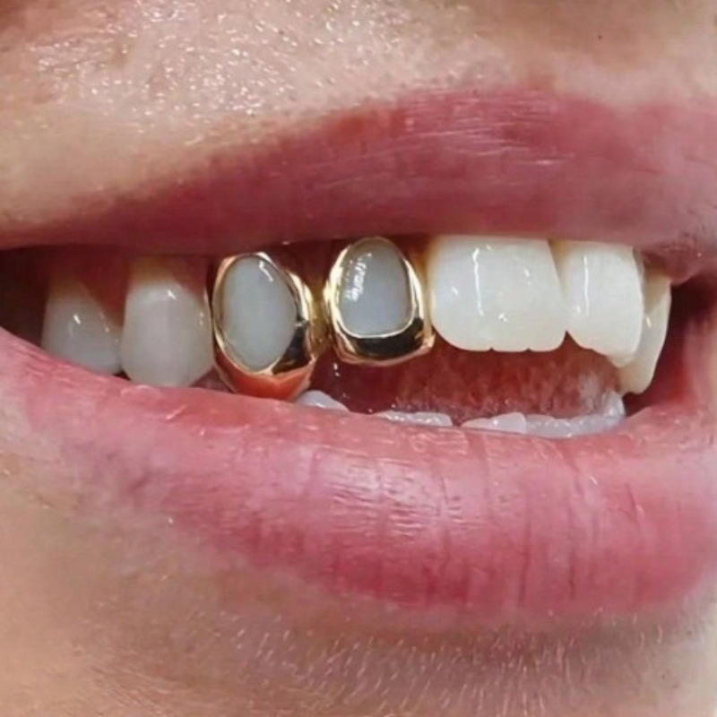 Juego de Joyería Dental Golden - Body Jewelry Changing Kit reseña y precio